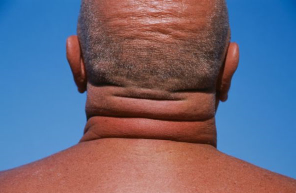 Antwerpen, Belgium egyetlen városa